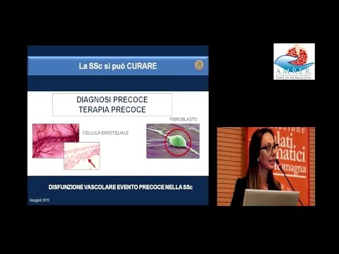 Tintura di radici ginepro con vodka per le articolazioni Dolore cisti ovarica