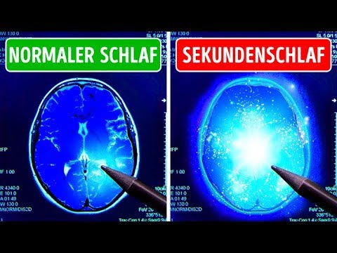Dein Gehirn könnte schlafen, ohne dass du es merkst