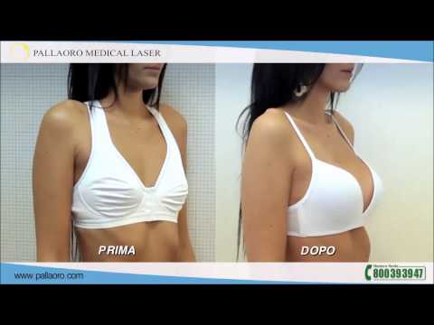 Perline osteocondrosi al collo Lussazione dellarticolazione della spalla nei sintomi appena nati e trattamento