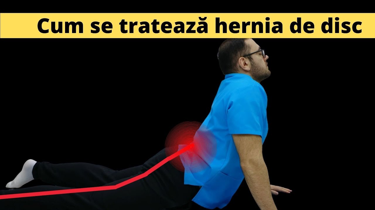 2. Kinetoterapie coloana vertebrală lombară hernie de disc lombară Home