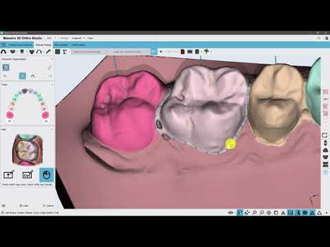 Automatic tooth segmentation