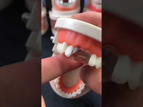 False teeth Molder Repair Gap Tooth, craps#🦷#bead#repair#cheap#savemoney#fill#fix#tooth