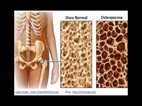 Cura di alcolismo nonconvenzionale Come fermare il delirium tremens