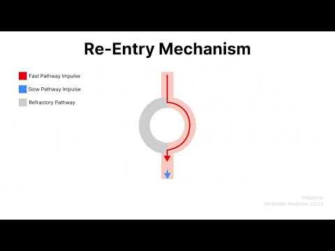 Re-Entry Mechanism
