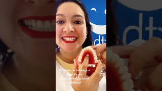 MyObrace: Posición de la Lengua