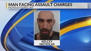 2 Deputies injured, man faces assault and battery charges