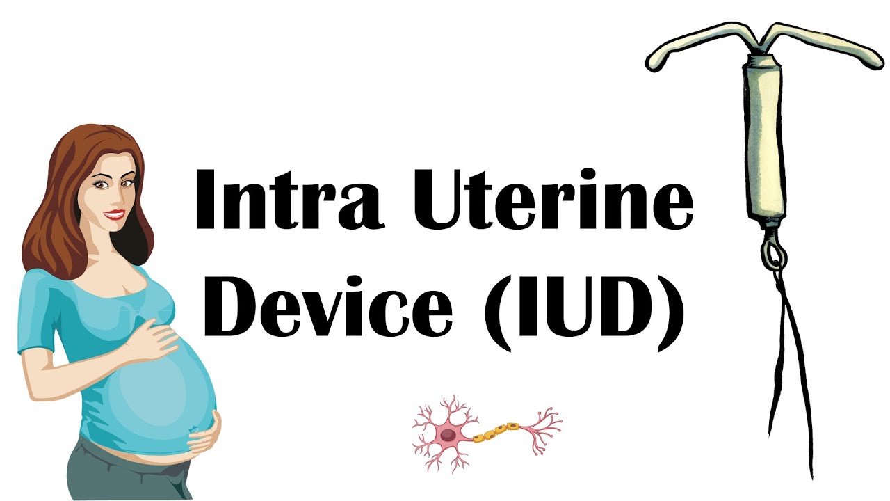 Intra Uterine Contraceptive Device (IUCD/IUD) - Types, Uses, Contraindications, & Complications