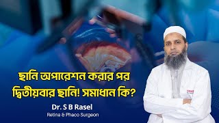 ছানি অপারেশন করার পর দ্বিতীয়বার ছানি !! সমাধান কি?