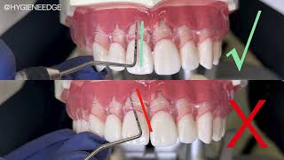 All Things Periodontal Probing with Kilgore International
