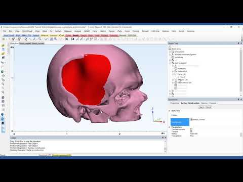 How to Design a Patient-Specific Cranial Plate | Mimics Innovation Suite | Materialise Medical