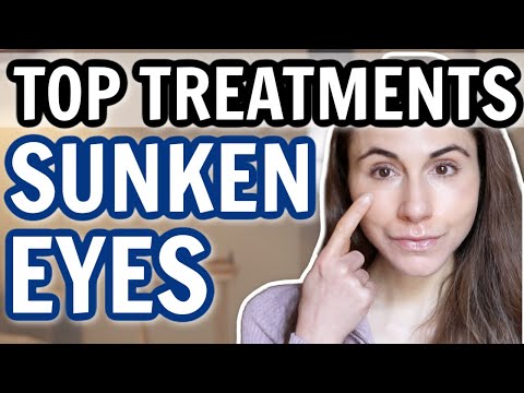 TOP TREATMENTS FOR SUNKEN EYES & HOLLOWS 👀 Dermatologist @DrDrayzday