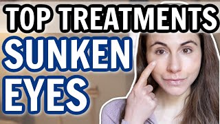 TOP TREATMENTS FOR SUNKEN EYES & HOLLOWS 👀 Dermatologist @DrDrayzday