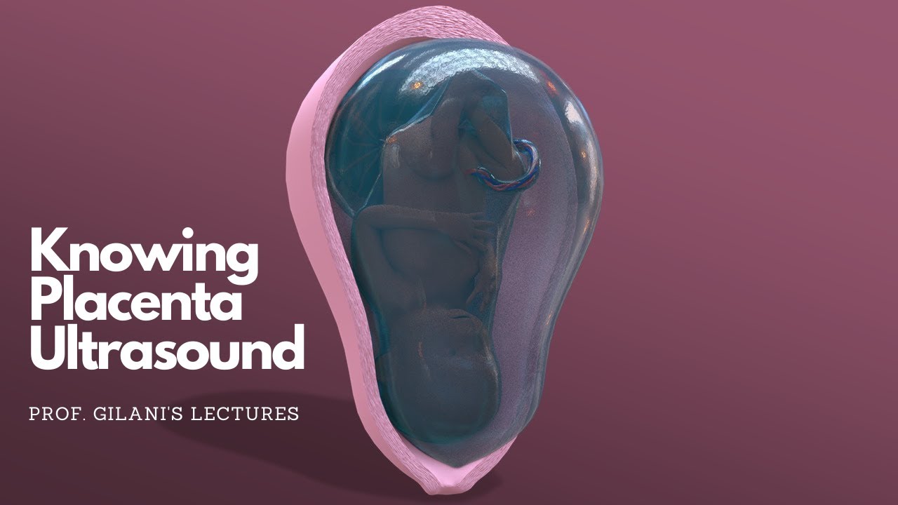 Knowing Placenta on Ultrasound - Animated