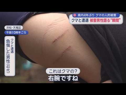 YouTube Video 「カモシカだと思った」次の瞬間…2m先でクマと遭遇　「顔を狙ったと思う」腕にはクマの爪痕…男性が明かす恐怖体験　浜松市