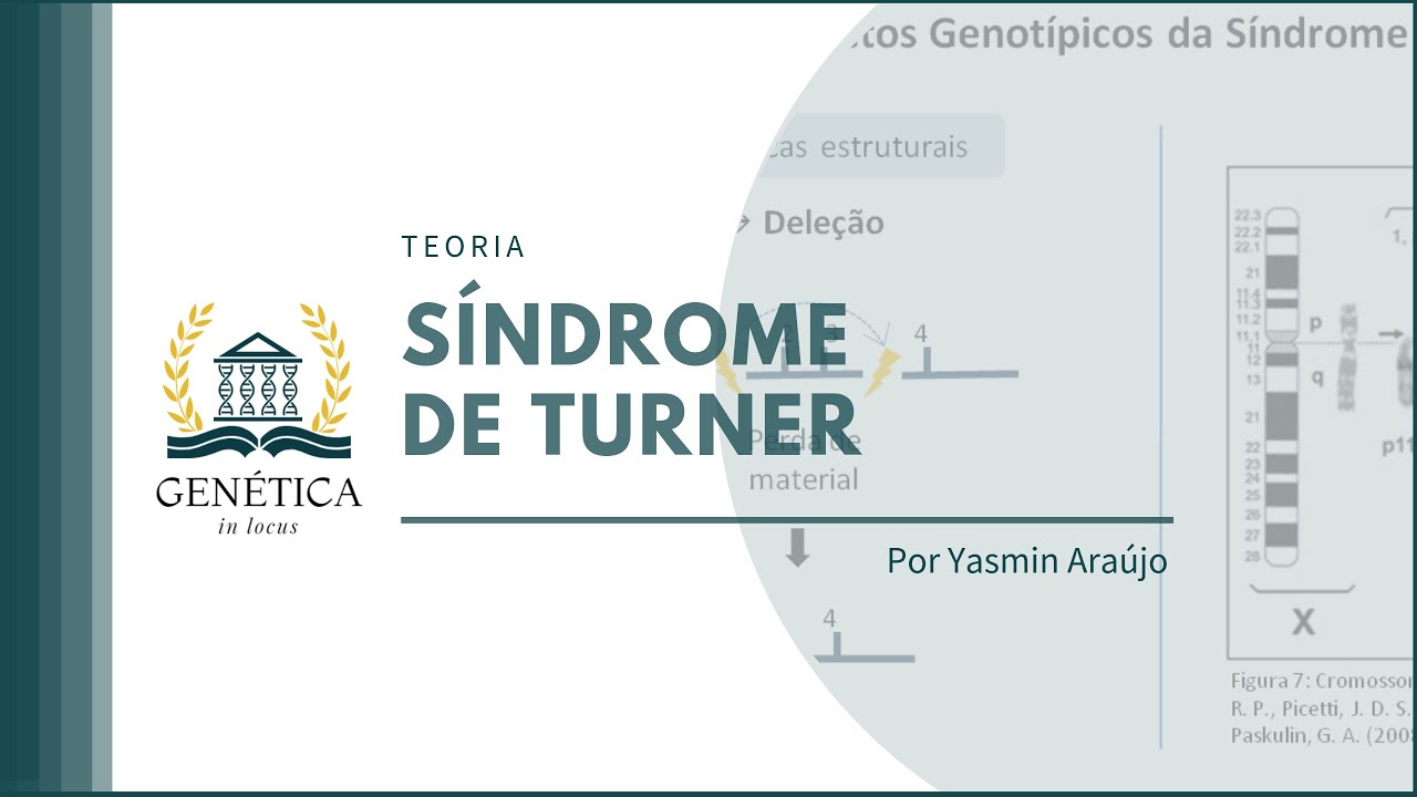 Teoria: Síndrome de Turner