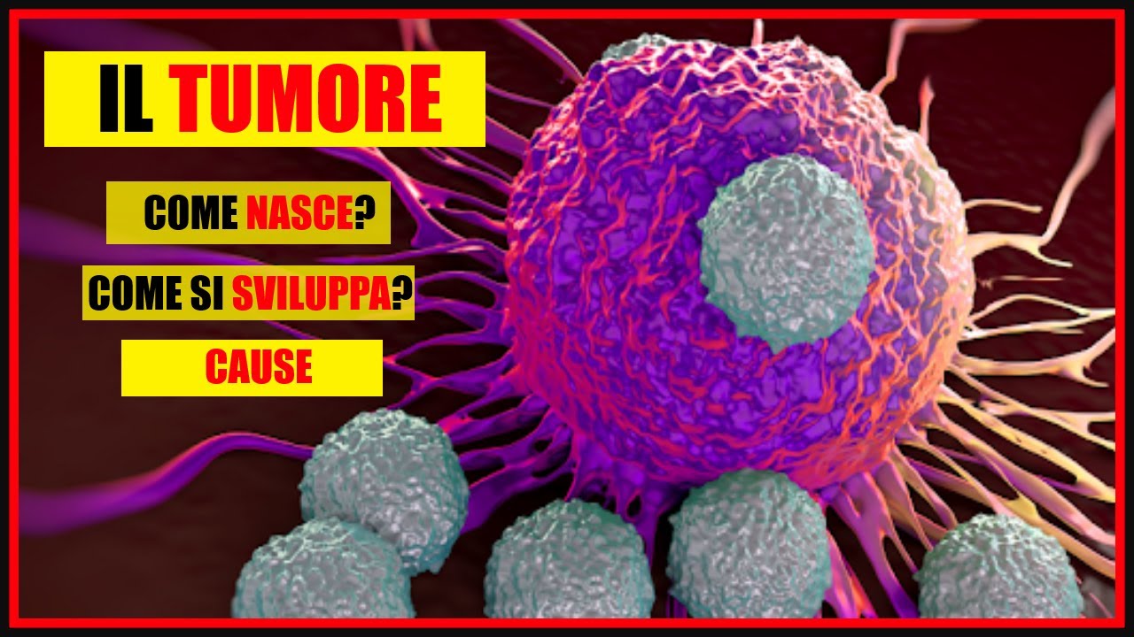 Cos'è un tumore e come nasce Quali sono le cause e come si sviluppa