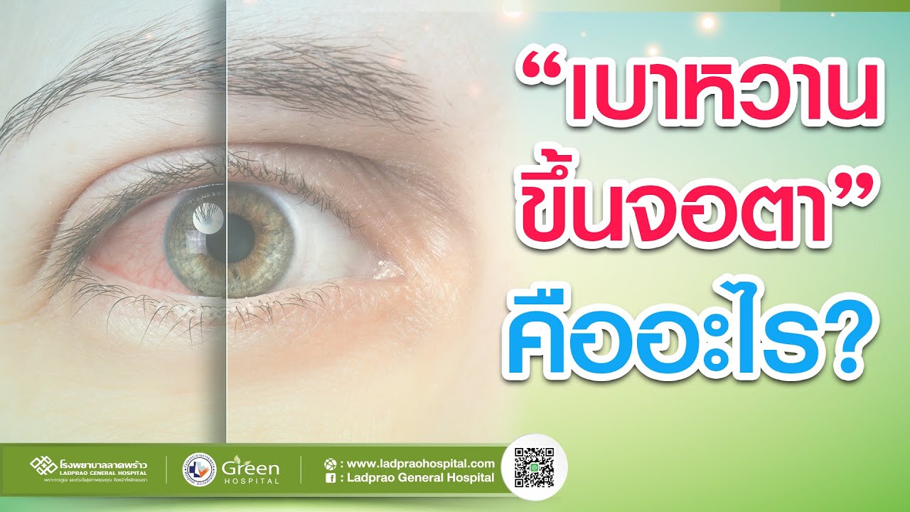 สาเหตุของโรคเบาหวานขึ้นจอประสาทตา