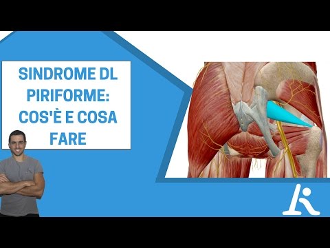 Intonaco con dolori articolari Grave dolore alla schiena non può alzarsi