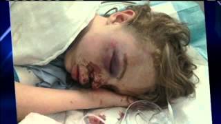 Enid Boy Recovering After Severe Beating