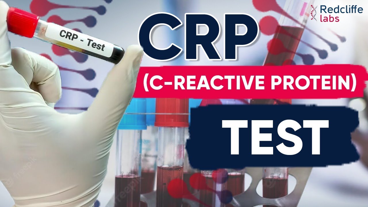 🤔What is CRP (C-Reactive Protein ) Test | Normal Levels of CRP | Redcliffe Labs