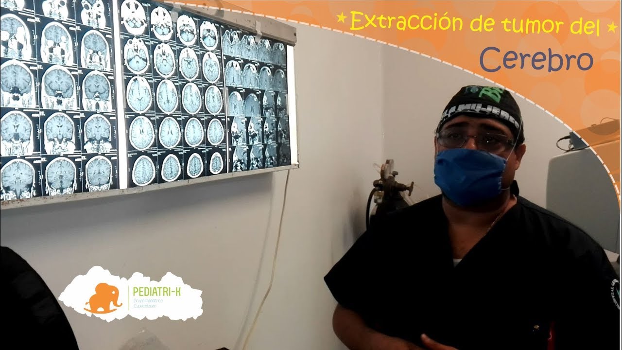 Anibal Fuentes Manzo-8