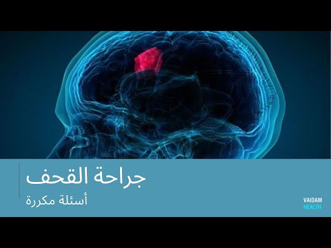 الأسئلة المتداولة حول حج القحف