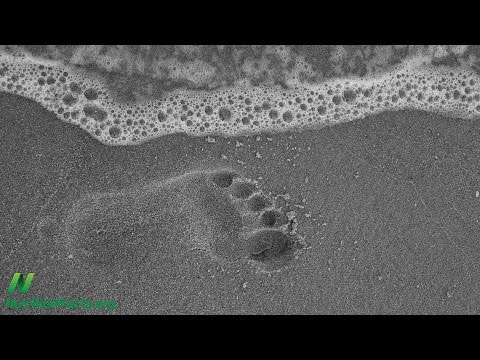 Lebensmittel für Diabetiker Diabetes, wenn Termine können sein