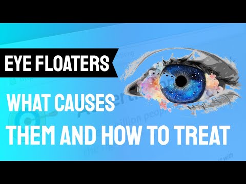 Floaters After Cataract Surgery - Causes and Management