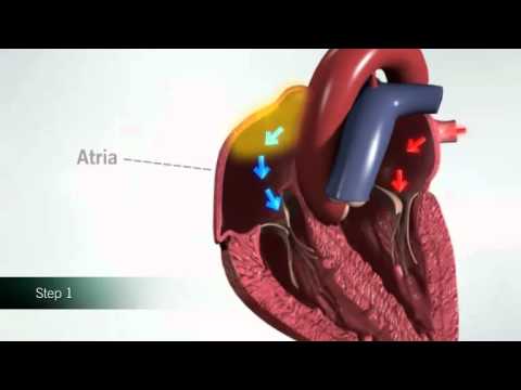 Normal Sinus Rhythm NSR