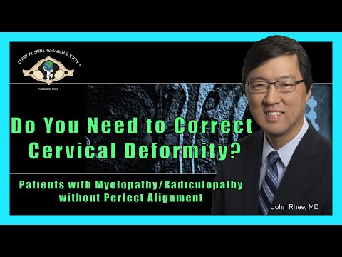 Do You Need To Correct Cervical Deformity?