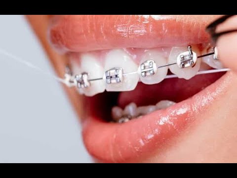 Video sản phẩm