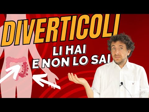 DIVERTICOLI: cosa sono, sintomi, dieta ideale e rischi di diverticolite