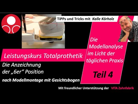 Leistungskurs Totalprothetik Teil 4 Anzeichnung der "6er"-Position-Modellmontage mit Gesichtsbogen