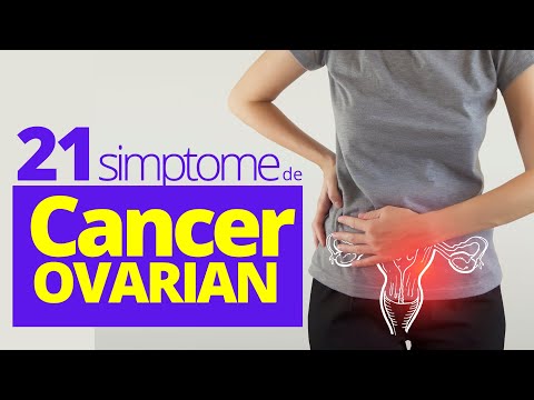 21 de simptome ale CANCERULUI OVARIAN. Ce investigații îl descoperă
