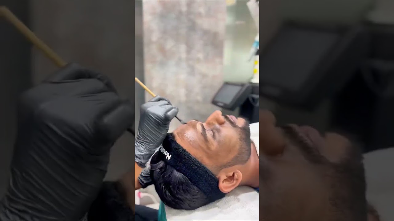 Carbon Laser Peel! This pain-free treatment gives you smoother, brighter skin in just one session..