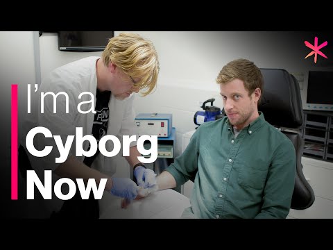 I Got a Chip Implanted in a Biohacking Garage