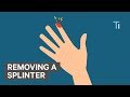 How To Remove A Splinter