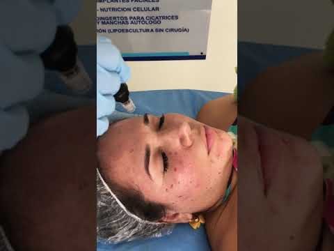 video 25OcvfKJT34