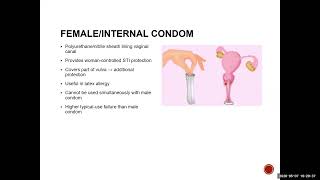 Contraception & Prevention of STI