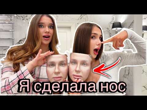 WHY I DECIDED TO HAVE RHINOPLASTY? MY HONEST STORY