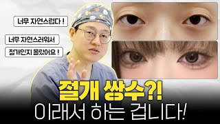 절개 쌍수한다고 다 부자연스럽지 않아요, 전 이렇게 합니다.