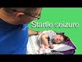 Startle Seizure in Child with Cerebral Palsy