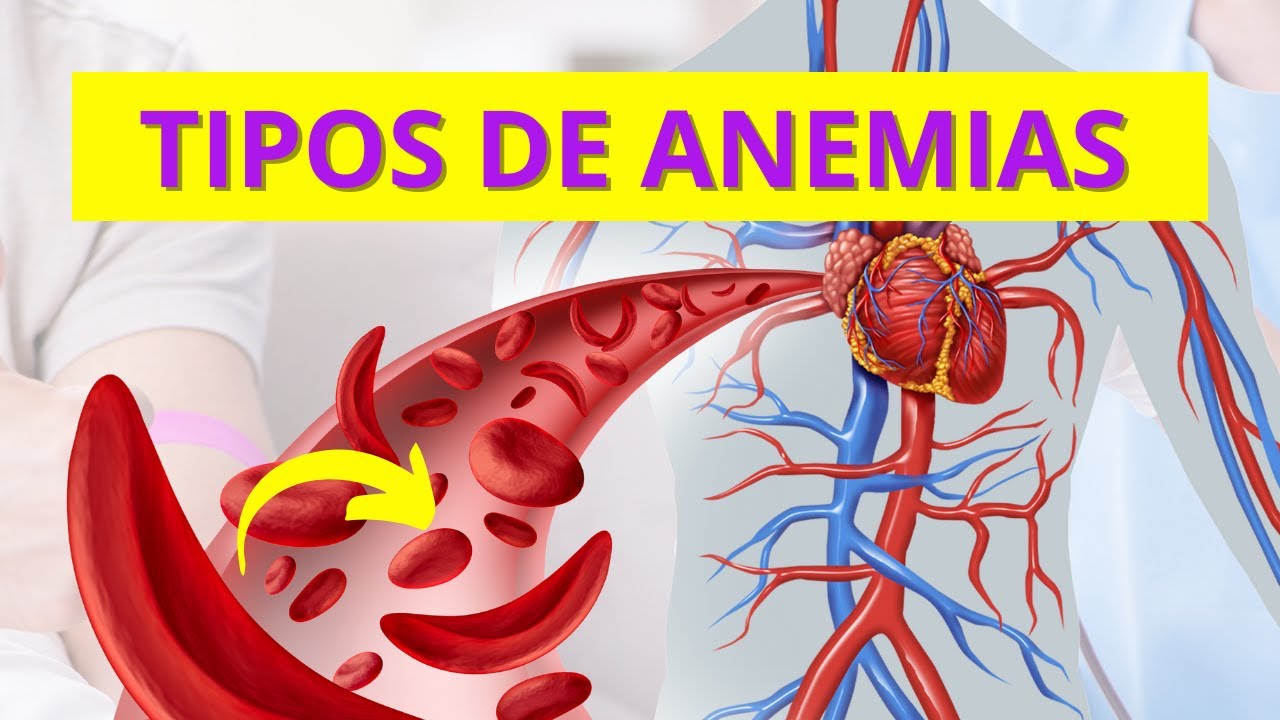 TIPOS DE ANEMIAS - QUAIS SÃO OS PRINCIPAIS TIPOS DE ANEMIA? | CONTEÚDO COMPLETO