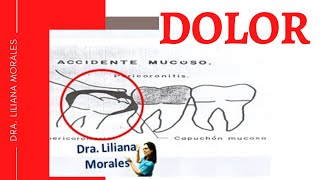 🥵Muelas del juicio cuánto dura el dolor/ pericoronaritis😲