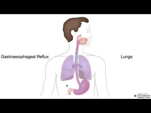 HCC 1475-2a-Esophagus - GERD