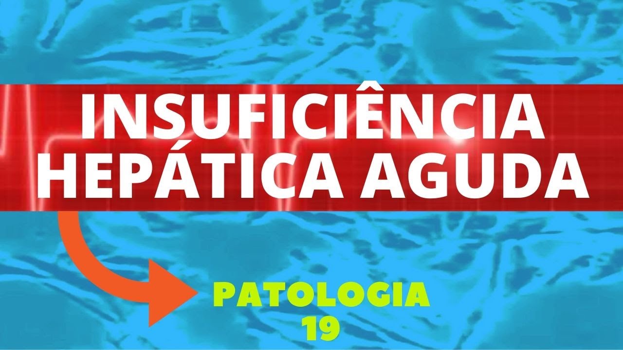INSUFICIÊNCIA HEPÁTICA AGUDA - PATOLOGIA 19