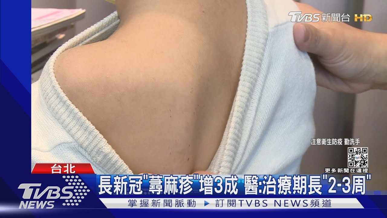 長新冠「蕁麻疹」增3成　醫：治療期長「2到3周」