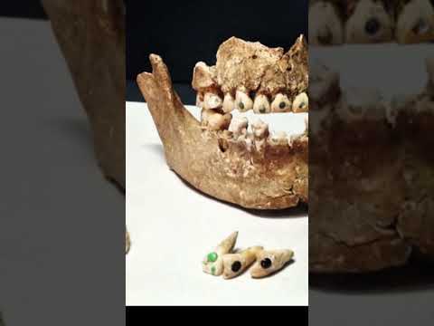 Ancient Maya Dental Bling! Art, Culture & Precision  #didyouknow #archaeologicalrevelations