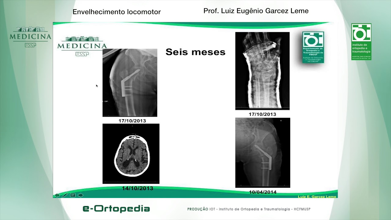 Envelhecimento locomotor - Prof. Luiz Eugênio Garcez Leme