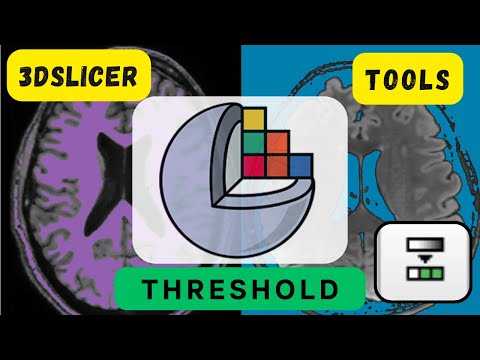 ⚒️3DSlicer Tools: Threshold